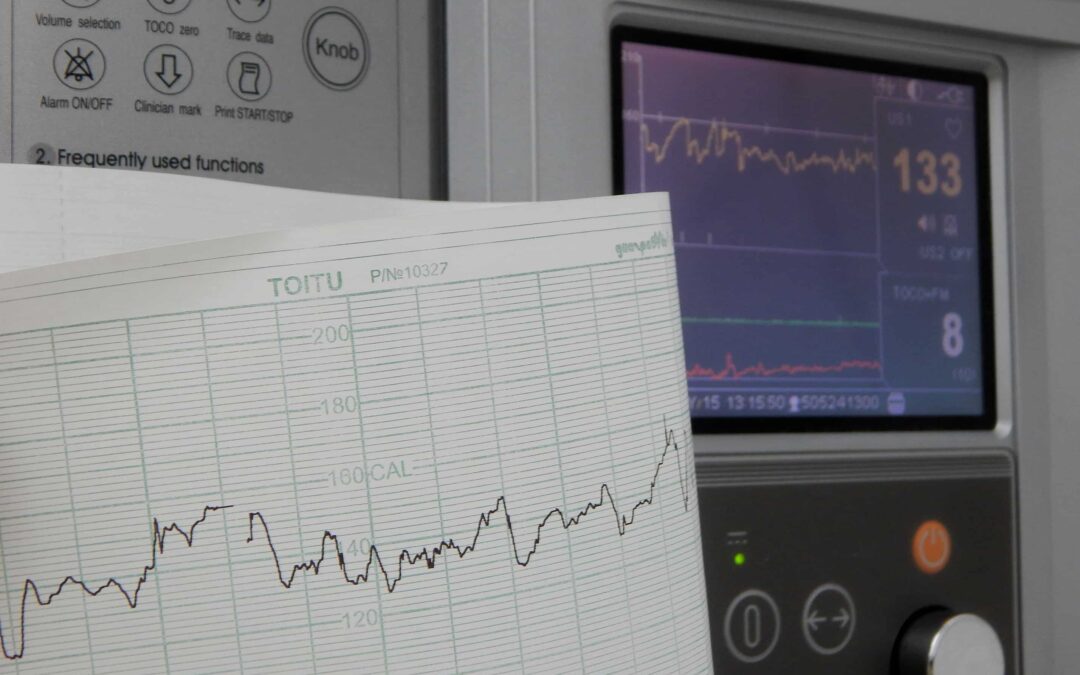 Ayuda a mejorar el manejo de la insuficiencia cardiaca en la diabetes