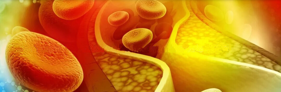 Puesta en marcha del Registro del control lipídico de los pacientes con diabetes